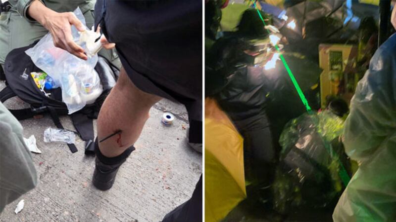 2019年11月17日，（左圖）香港警方表示一名警察傳媒聯絡隊隊員，在衝突期間被箭射中小腿。（右圖）有示威者遭燒傷。（香港警察/李智智攝）