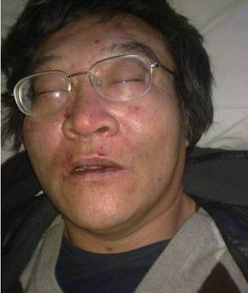 Writer_Hong_Feng_beaten305.jpg