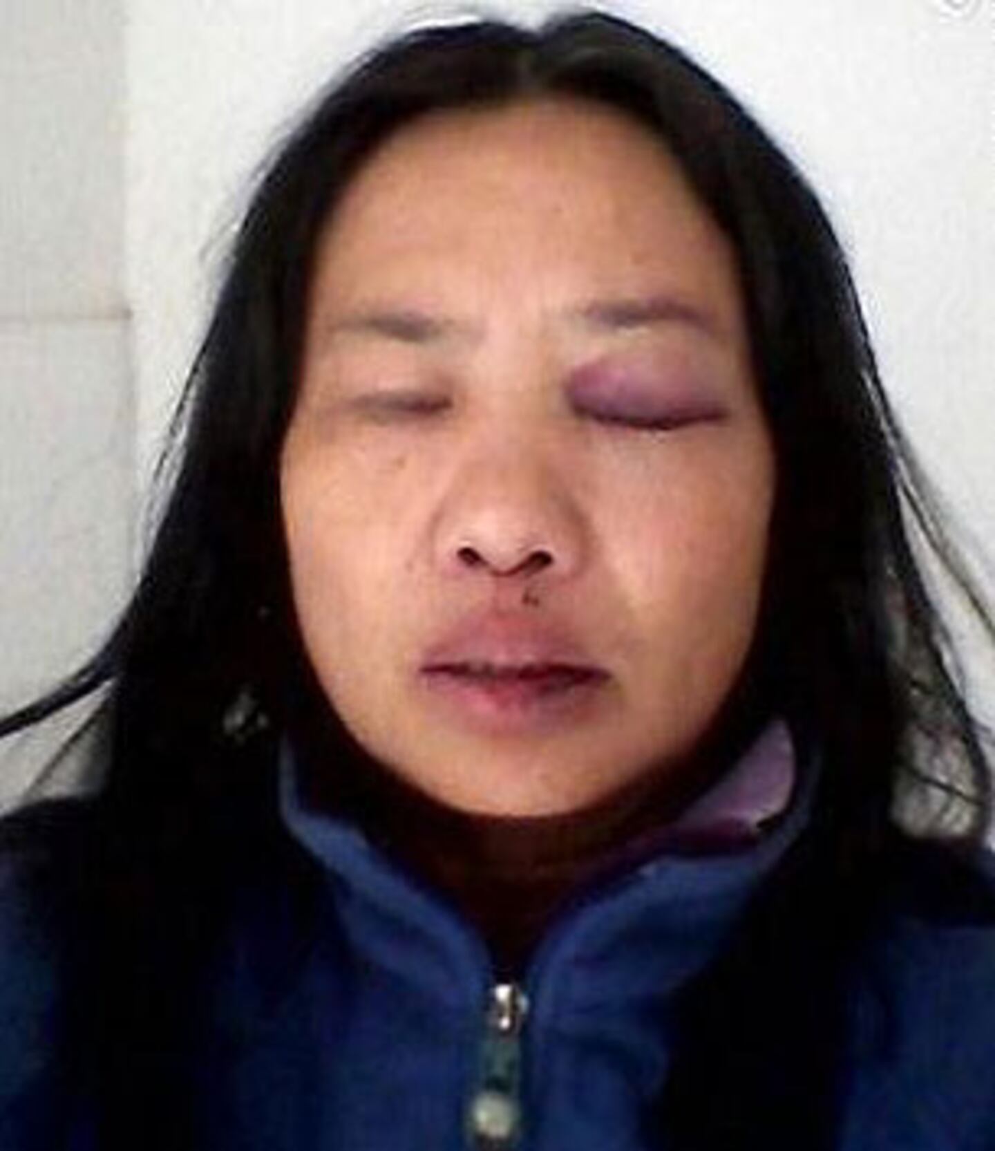 在京躲藏多月等待周四到北京人民大會堂喊冤的河南鄭州訪民賈女士,周三晚遭截訪人員打傷,被關進黑監獄。 (相片由訪民提供)