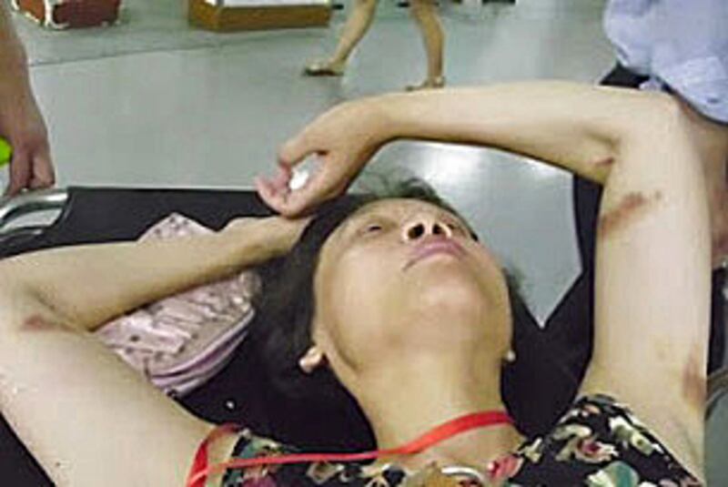 上海訪民孫洪琴周三到高院抗議遭警察拖行數十米,她雙手布滿瘀傷。(相片由孫洪琴提供)