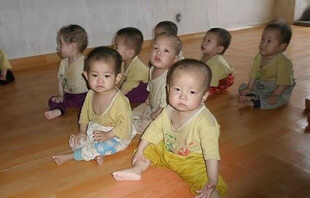 영양실조에 걸린 북한 어린이들의 자료사진.