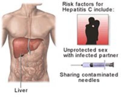 HepatitisC200.jpg