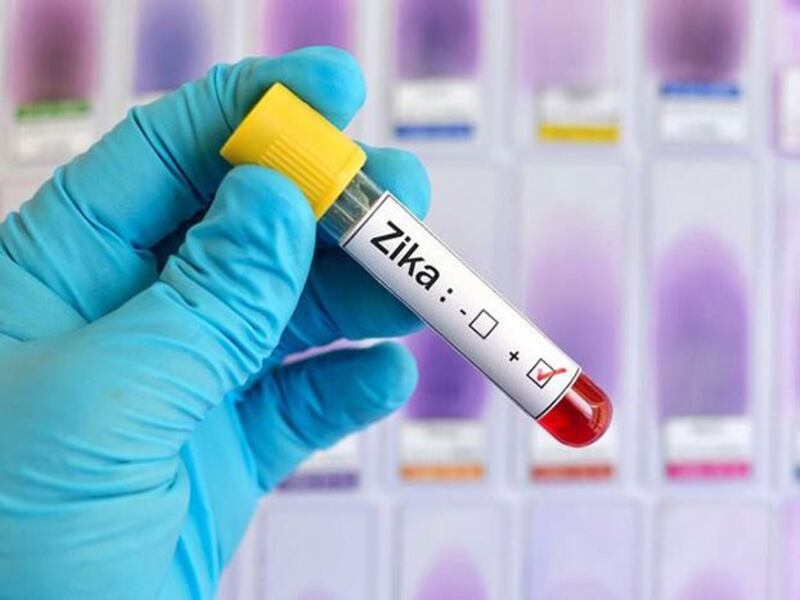 Thế giới vẫn chưa tìm ra vaccine phòng chống Zika.