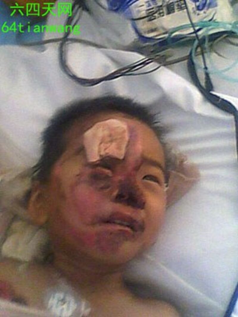 图片：陕西警察追击残疾访民致车祸翻车重伤父子，5岁幼儿烫伤无钱医治。（六四天网）