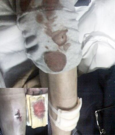 图片：广州维权律师刘士辉被打伤，正在医院治疗。（野渡提供/记者乔龙）