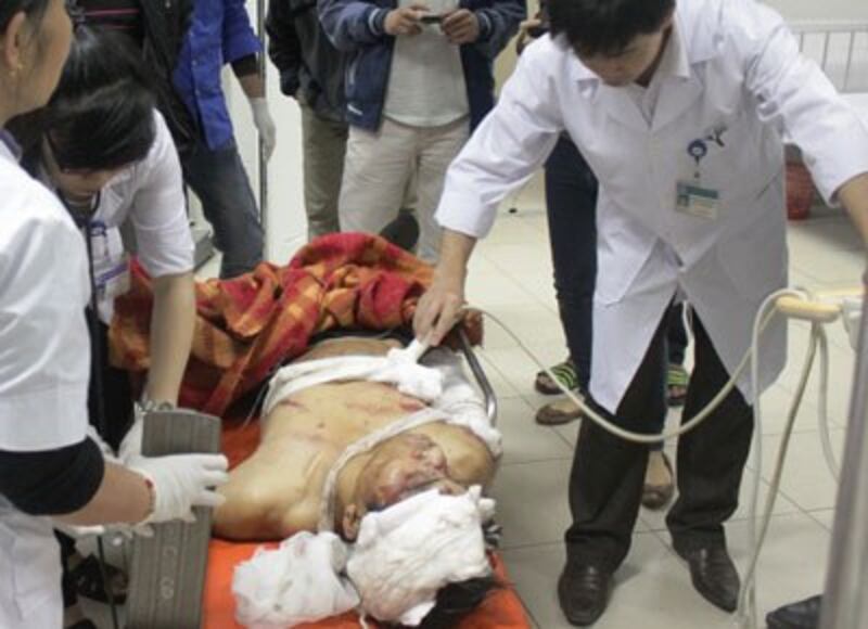 Lực lượng cứu hộ đưa một người bị nạnNhân viên y tế cấp cứu cho một người bị nạn trong vụ sập giàn giáo tại khu công nghiệp Formosa, Vũng Áng, Hà Tĩnh. RFA PHOTO. ra ngoài trong vụ sập giàn giáo tại khu công nghiệp Formosa, Vũng Áng, Hà Tĩnh. RFA PHOTO.