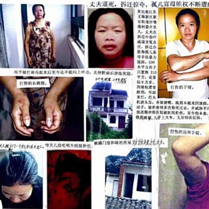 江蘇女訪民黃民菊上訪五年嚐盡酷刑，包括被牙籤戳眼皮，香煙燙咀巴及冷水灌鼻孔。(相片由六四天網提供)