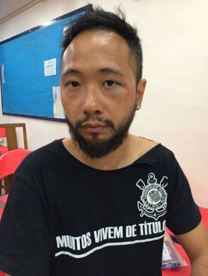 2014年10月15日，公民黨成員曾健超懷疑被警察傷後，到醫院驗傷，無需留醫。（公民黨facebook）