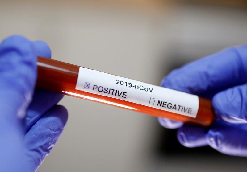Hình minh hoạ. Ống nghiệm có tên virus Corona. Hình chụp hôm 29/1/2020