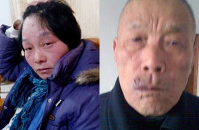 常州趙家村拆遷戶王建新一家四口，12月12日被當局強拆時,被拆遷人員打傷，妻子傷勢較重。王建新的岳父亦受傷，在醫院治療一星期後出院。（照片由拆遷戶提供）
