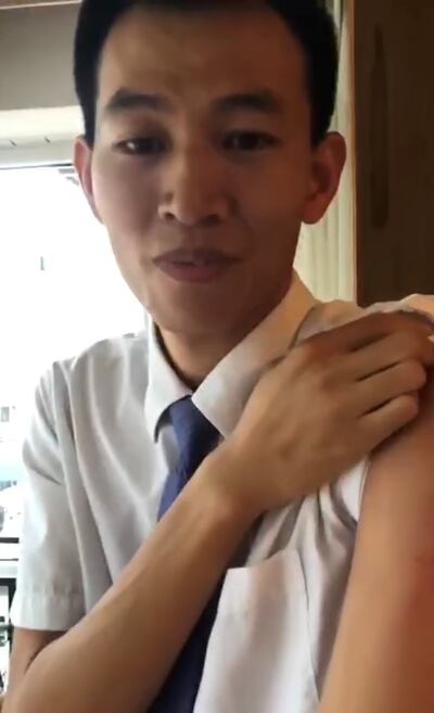 戴志超展示手臂上的傷痕。（視頻截圖）