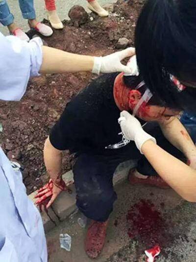 2015年5月16日,有示威者被打得頭破血流。(現場人士攝)