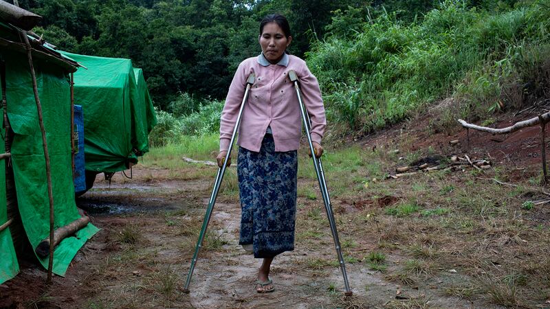 ဖယ်ခုံမြို့နယ်အနီးရှိ စစ်ဘေး ဒုက္ခသည်စခန်းတွင် မြေမြှုပ်မိုင်းကြောင့် ခြေထောက်တစ်ဖက် ဆုံးရှုံးလိုက်ရသည့် မလှဝင်းအား ၂ဝ၂၃ ခုနှစ် ဇူလိုင်လ ၂၉ ရက်နေ့တွင် တွေ့ရစဉ်။ (Photo : AFP)