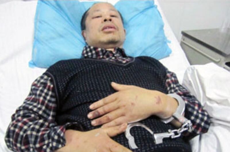 芙蓉區西龍村拆遷戶王喜灝丈夫，被拆遷人員打傷後送院治療，仍未被除掉手铐。(照片來自拆遷戶)