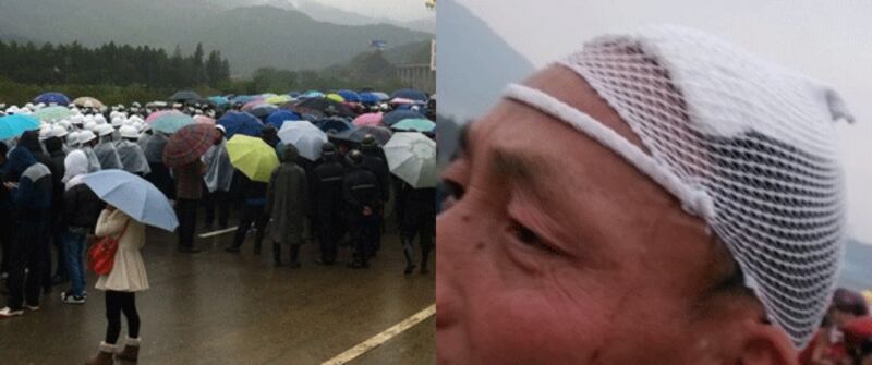 左图：數百名仁山村村民，周日(12月15日)集體阻斷高速公路，抗議地方政府私賣土地。右图：村民較早前到被強徵的土地上阻工，與開發商逾百名工人和保安發生衝突，廿名村民受傷送院，圖為其中一名頭部受傷的村民。（相片由現場村民提供）
