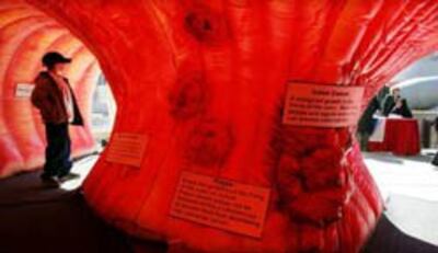 000_52376863MT001_colon-250.jpg