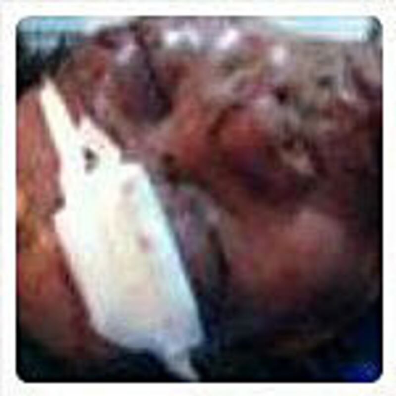 demolition_injured150.jpg