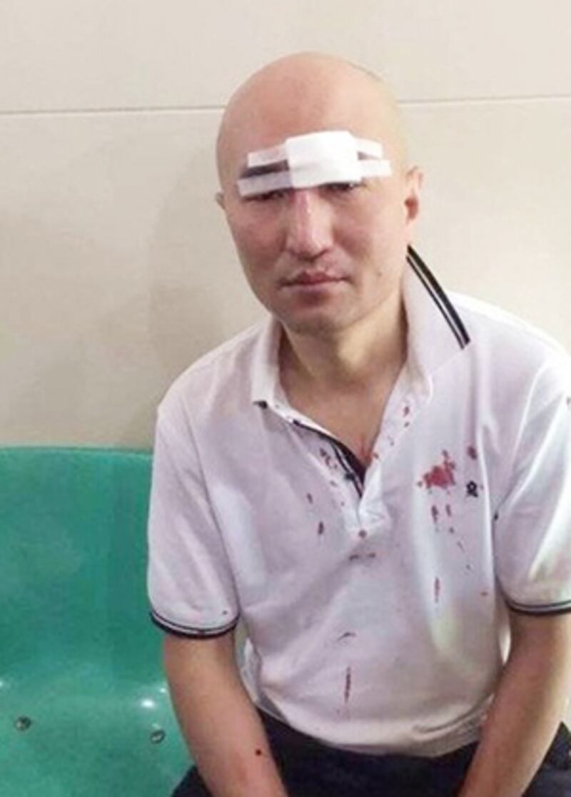 其中1名投資受害人被打至頭部受傷。(照片來自中國天網)