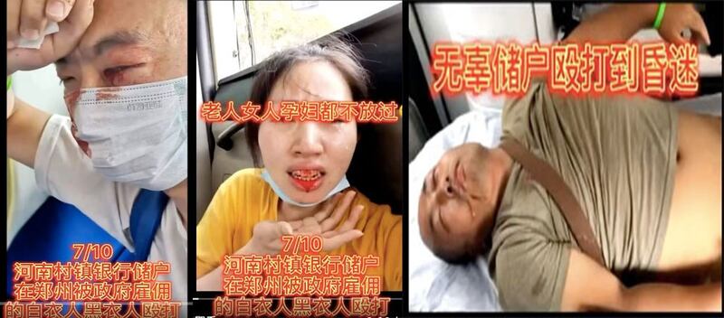 左图：一男子眼睛被打伤流血。中图：一女子嘴角被打流血。右图：一男子颈部被打至骨折。（视频截图）