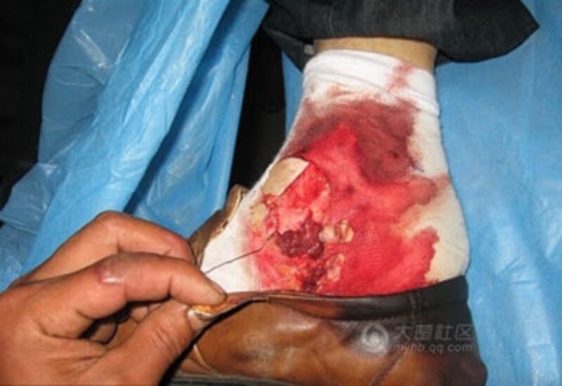 hubei_suicide_cao_wounds350.jpg