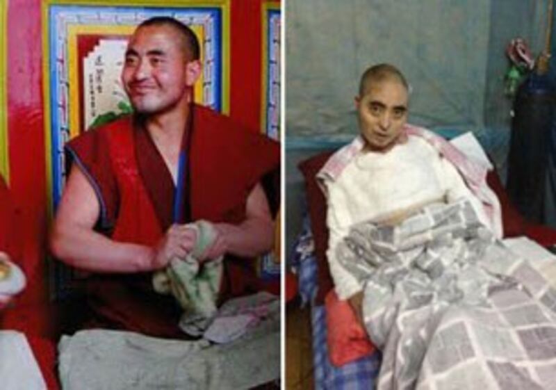图片：9月29日过世的青海隆务寺僧人嘉央班丹，摄于自焚前与自焚后。（消息人士早前提供）