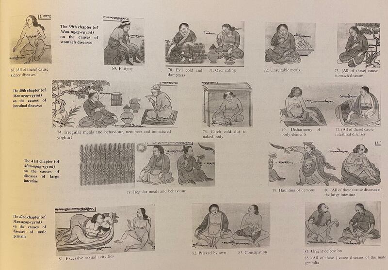 《四部医典》里所绘的各种疾病图示。（Palden提供）