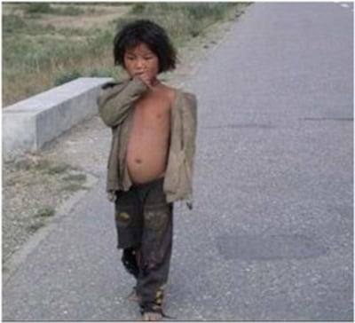 Những em bé đáng thương