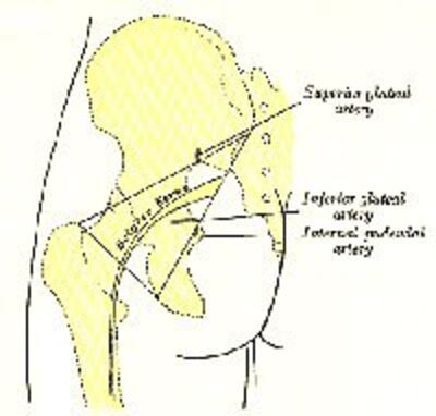 Sciatica200.jpg
