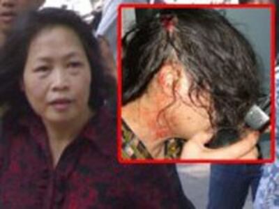 TranKhaiThanhThuy-injury-250.jpg