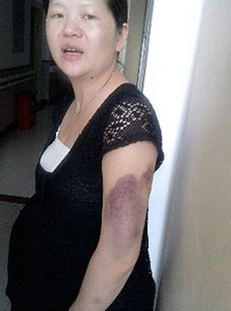 XiaoAiying_abortion305.jpg
