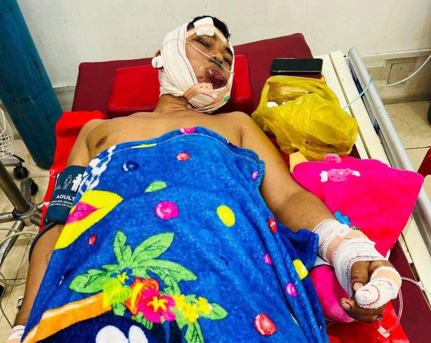 Ny Nak was treated at a private clinic in 2023 after he was beaten by people wielding metal batons. (Facebook/Ny Nak)
