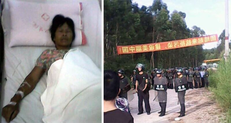 7月19日,廣東省化州市新安鎮當局出動過百警察,抓捕波羅垌村村民。波羅垌村村民李女士被警察打傷胸部,目前仍在留醫。(網上圖片)