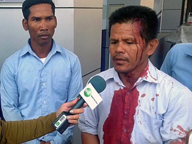 A former Capitol Tours bus driver who was beaten during a protest talks to reporters in Phnom Penh, Feb. 6, 2016.
