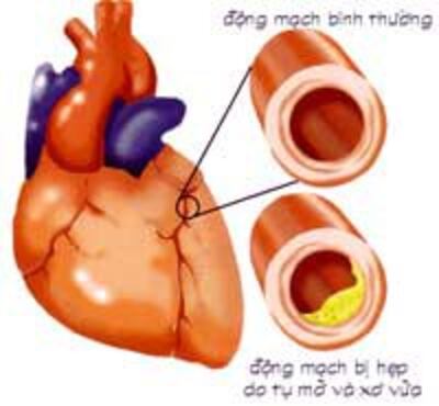 HeartTim200.jpg