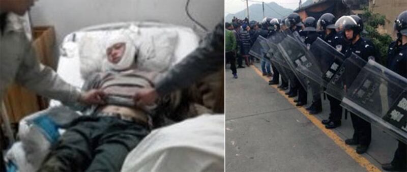 當局調派大批特警到飛鸞鎮村民示威現場戒備,雙方一度對峙,村民結果遭特警暴力驅散,衝突中十四名村民被打傷。被打傷的村民,至今仍然留院,當中一人傷勢危重。(現場人士提供)