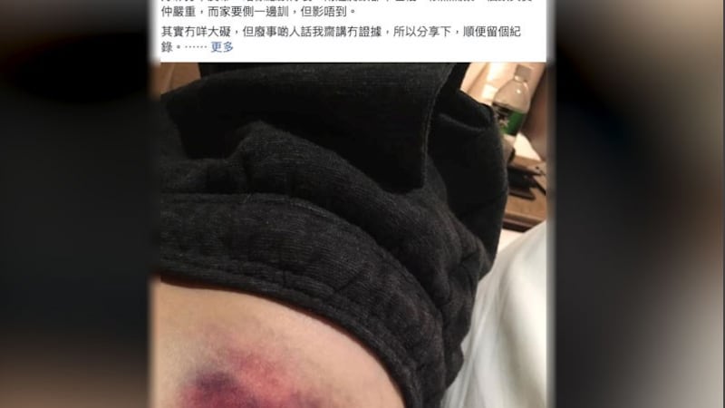 陈浩天赴台前在港遇袭,他脸书po文显示伤势。(摘自陈浩天脸书)