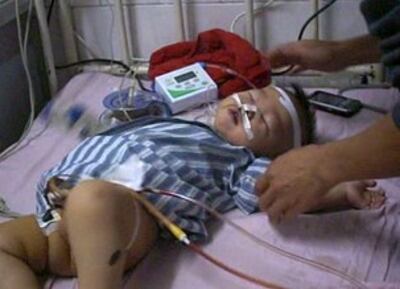 图片：杨欢出院后，仍然双肾积水，输尿管扩张，而医院却表示，患儿病情与奶粉无关。（志愿者提供）