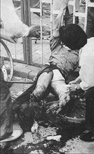fangzheng legs
