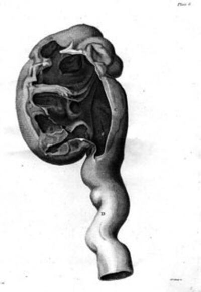 kidney-220.jpg