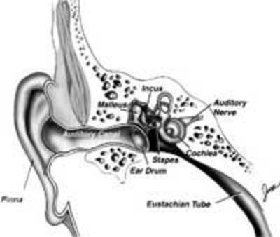 EarInfection200.jpg