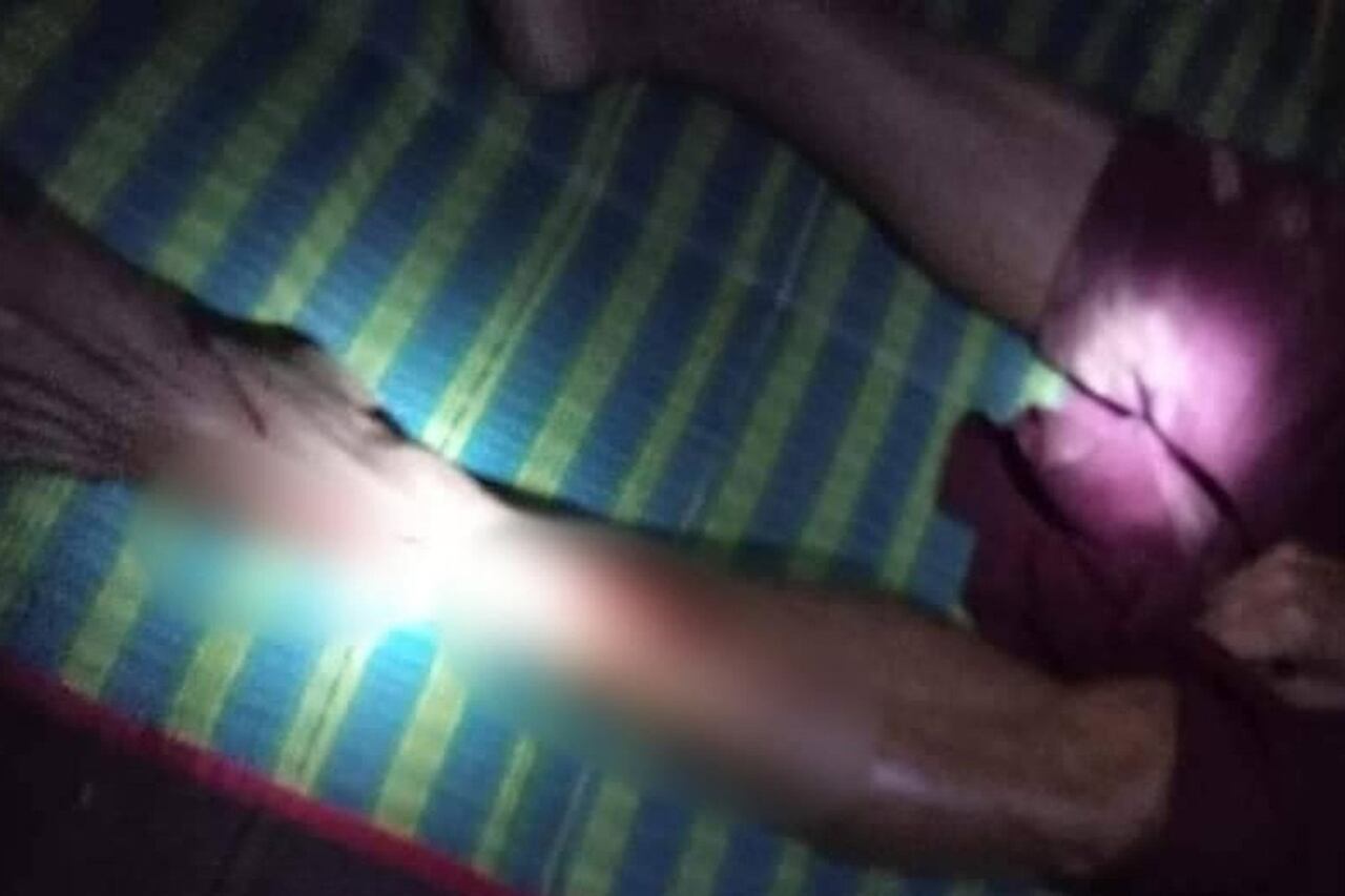 ဘီးလင်းမြို့နယ် မိချောင်းအိုင်ရွာ ဘုန်းတော်ကြီးကျောင်းထဲသို့ လက်နက်ကြီးကျည် ကျရောက်ပေါက်ကွဲခဲ့သဖြင့် ဒဏ်ရာရရှိခဲ့သည့် ရဟန်းတစ်ပါးအား ၂၀၂၃ ခုနှစ် ဖေဖော်ဝါရီလ ၁၁ ရက်နေ့က တွေ့ရစဉ်။