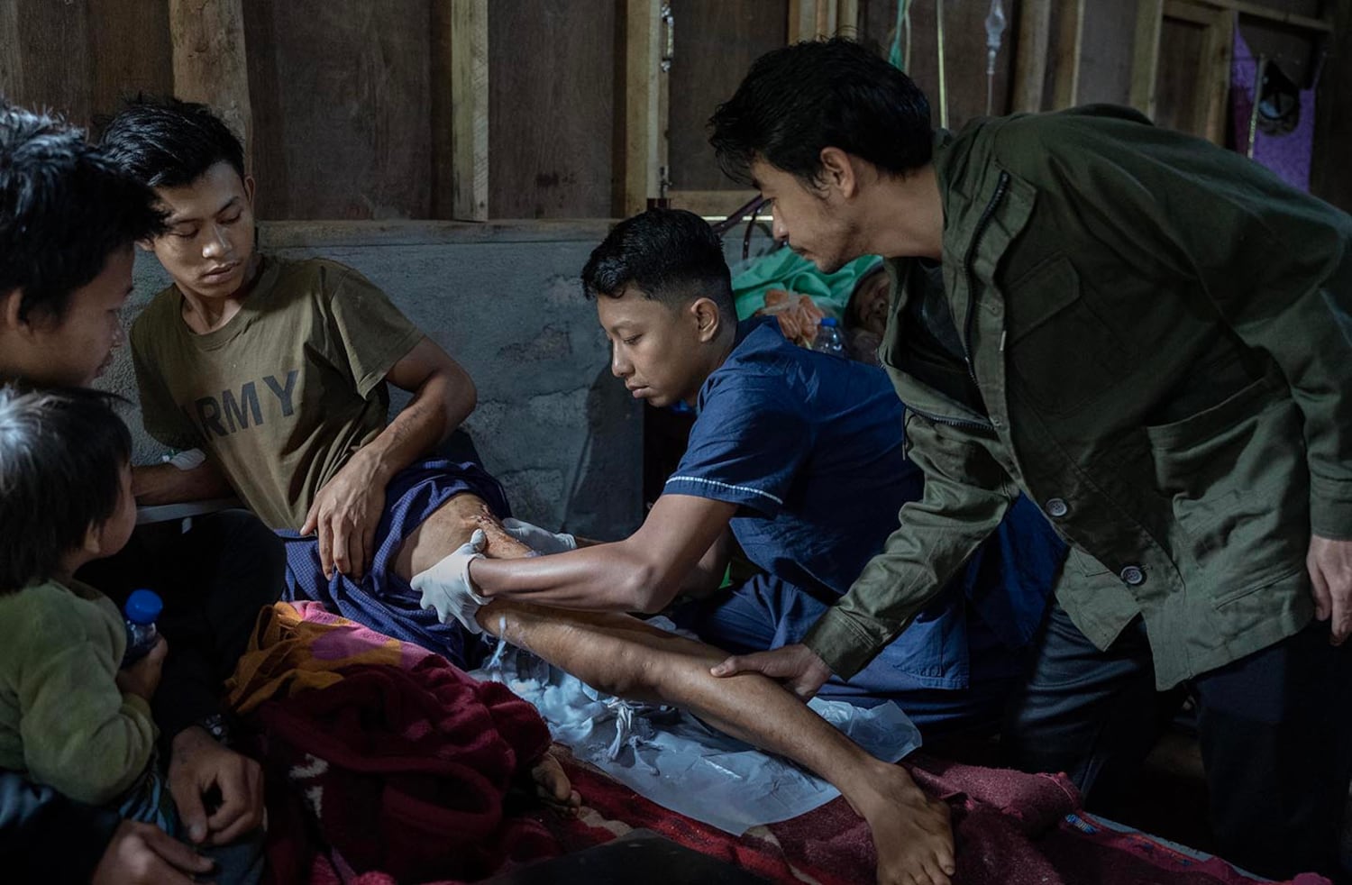 Surgeon Aung Ko Myint, right, and Dr. Yori treat gunshot wounds suffered by Saw Thein Win when he was shot by Myanmar junta security forces during a protest of the 2021 coup, at O-1 hospital in Demoso, Kayah state, Nov. 6, 2024.