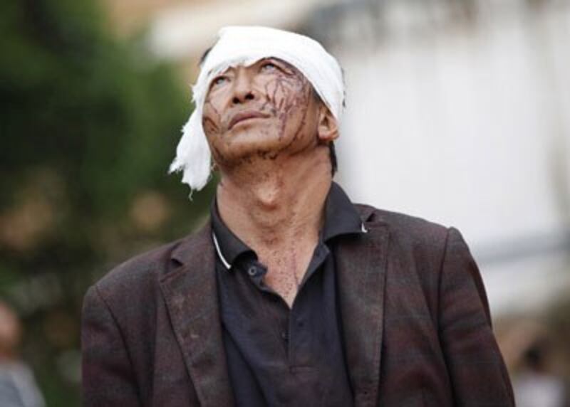 An injured earthquake survivor weeps in Yunnan's Ludian county, Aug. 4, 2014. Credit: AFP