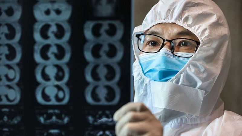 图为武汉医生看病患的CT片。（法新社）