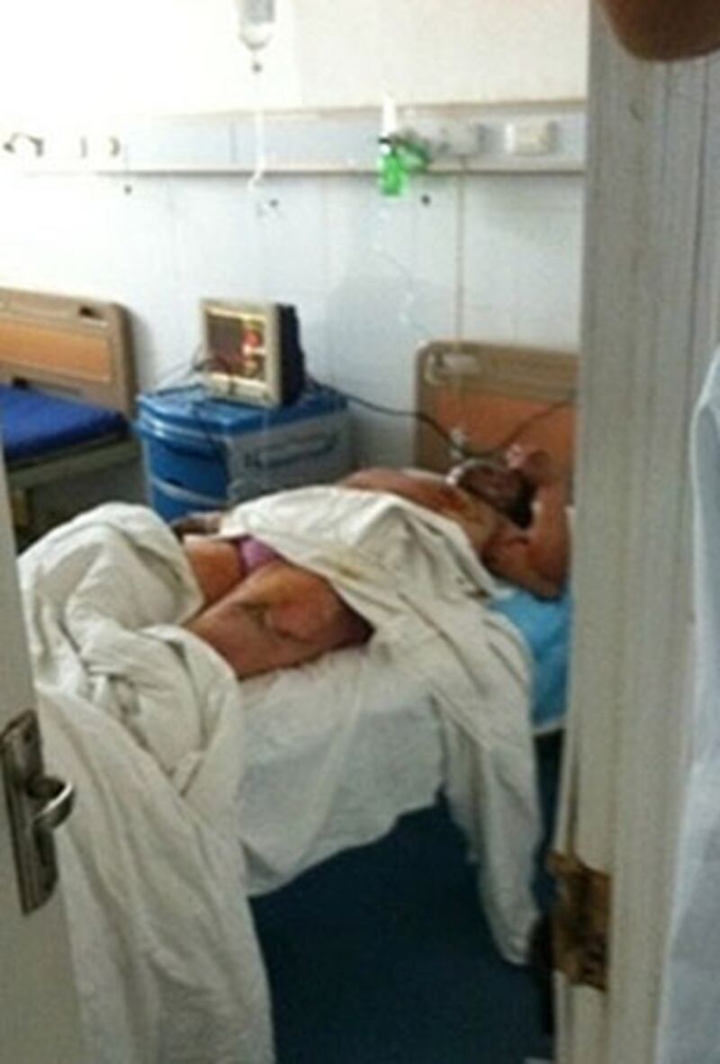 湖北荊門巿屈家嶺區拆遷戶凡桂岑,11月26日在區政府外自焚受傷,全身八成燒傷。(照片由拆遷戶提供)