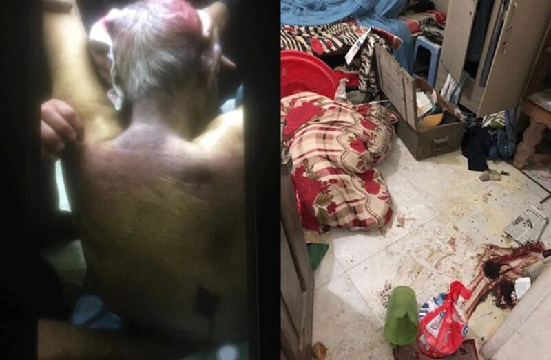 Ông Lê Đình Kinh với những vết bầm trên lưng và căn phòng bị lục tung với nhiều vết máu