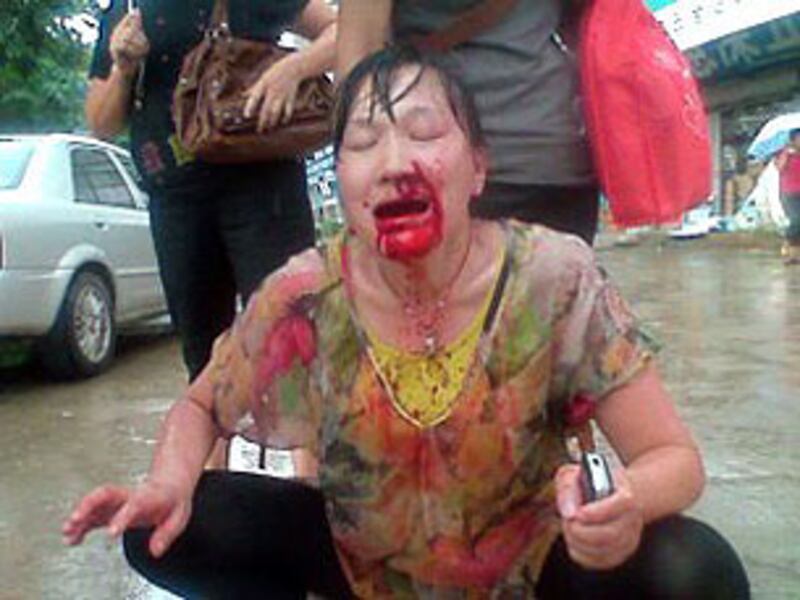 0826_labor_bleeding305.jpg