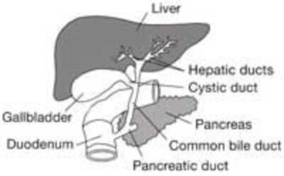 GallstonesTuiMat200.jpg