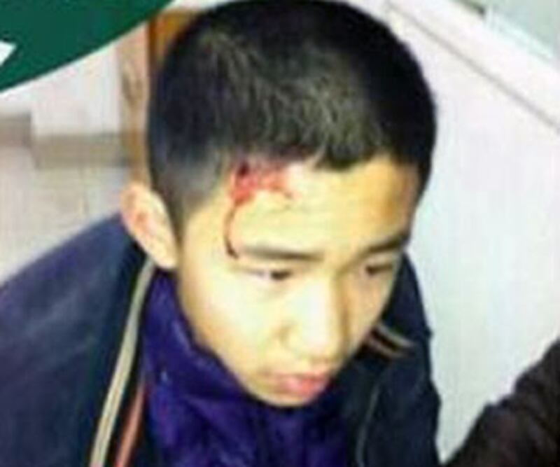 南通拆遷戶家中14歲的季煒亦頭部及手腳被斬傷。(照片由拆遷戶提供)