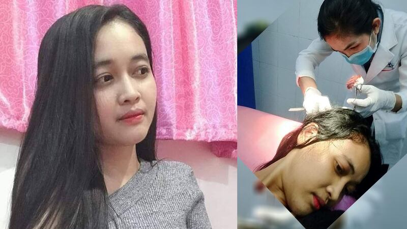 យុវតី អៀង ម៉ារីណា ហៅក្រៅថា ស្រីមាស អ្នកគាំទ្រគណបក្សសង្គ្រោះជាតិម្នាក់ត្រូវជនមិនស្គាល់មុខវាយរបួសក្បាល នៅល្ងាចថ្ងៃទី១១ ខែឧសភា ឆ្នាំ២០២០។